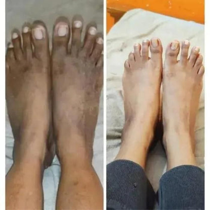 Lucacci Sinche Kojic Skin Whitening Facial Body Soap Pack of 4 - 300 g